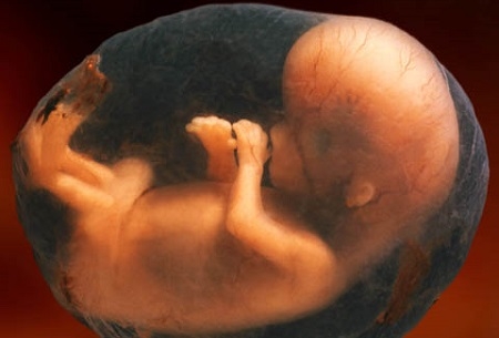 NextImg:Abortion Pill No Longer Listed on Kroger and Sam’s Club Websites