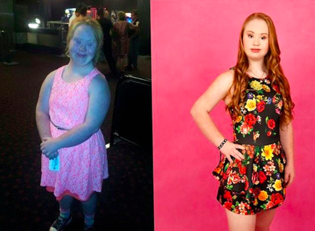 Aspiring Teen Model With Down Syndrome Redefines Beauty Standards Mrctv 